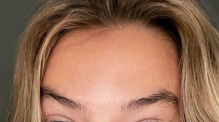 Na